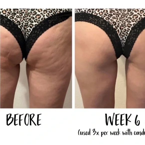 NuSkin Renu Spa in box - Picture 9 of 9